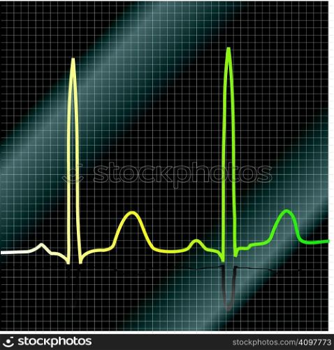 A ecg that show heart beat with a black and silver background