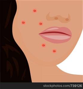 A young woman having acne infection problem skin concept vector illustration