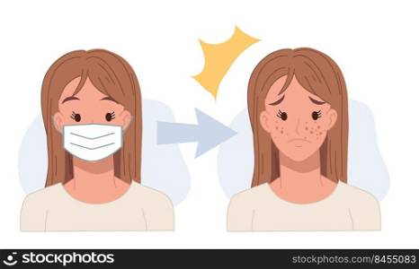 Acne caused wearing face mask.acne concept.pimples. skin problems .Flat vector cartoon character illustration.