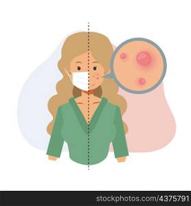 Acne caused wearing face mask.Maskne concept.pimples. Acne closeup.Flat vector cartoon character illustration.