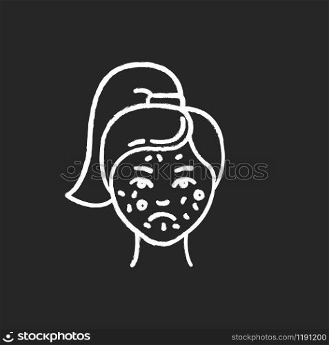 Acne chalk icon. Pimples on female face. Skincare for inflammation and irritation. Facial treatment. Puberty and teenager health problem. Dermatology. Isolated vector chalkboard illustration