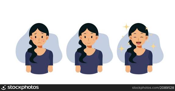 Acne concept.pimples. skin problems. step of Clear of acne.Flat vector cartoon character illustration.
