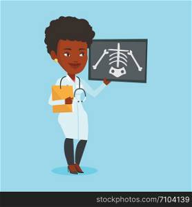 African-american female doctor examining a radiograph. Young smiling doctor looking at a chest radiograph. Female doctor observing a skeleton radiograph. Vector flat design illustration. Square layout. Doctor examining radiograph vector illustration.