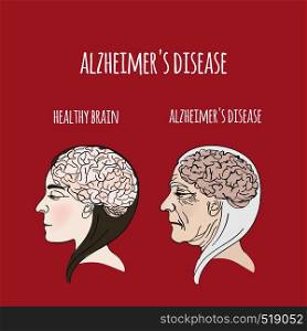 ALZHEIMER DISEASE Dementia Medicine Vector Illustration