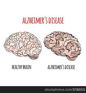ALZHEIMER Disease Memory Loss Medicine Vector Illustration