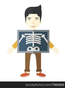 An asian patient with x-ray screen showing his skeleton vector flat design illustration isolated on white background. Vertical layout.. X-rays.