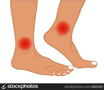 Ankle joint pain treatment vector illustration.