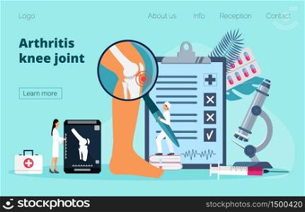 Arthritis knee joint concept. Tiny doctors treat rheumatism, osteoarthritis, make x ray scan. World arthritis day in October. Flat concept for landing page, banner.. Arthritis knee joint concept. World arthritis day in October.
