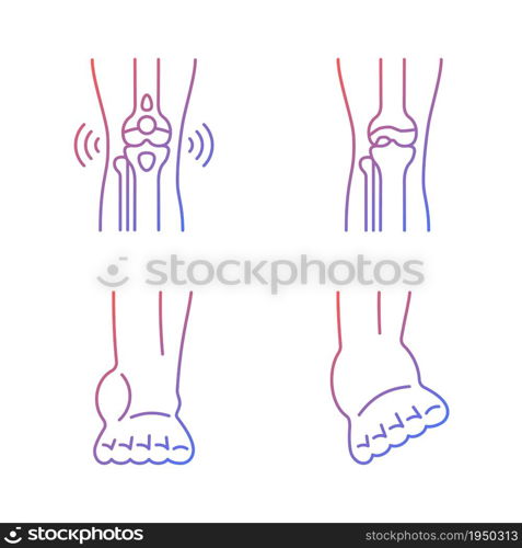 Arthritis leg pain gradient linear vector icons set. Degenerative joint disease. Bursitis condition. Muscles strains. Thin line contour symbols bundle. Isolated outline illustrations collection. Arthritis leg pain gradient linear vector icons set