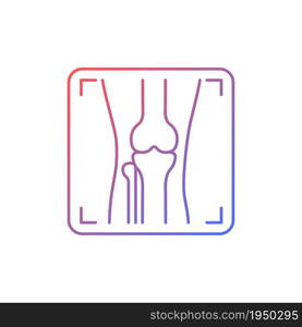 Arthritis x ray gradient linear vector icon. Joint deformity depiction. Osteoarthritis diagnosis. Medical imaging. Thin line color symbol. Modern style pictogram. Vector isolated outline drawing. Arthritis x ray gradient linear vector icon