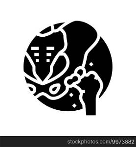 articular cartilage gout glyph icon vector. articular cartilage gout sign. isolated contour symbol black illustration. articular cartilage gout glyph icon vector illustration