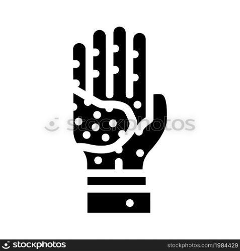 atopic dermatitis glyph icon vector. atopic dermatitis sign. isolated contour symbol black illustration. atopic dermatitis glyph icon vector illustration