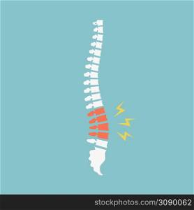 Backache. Back pain vector icon illustration isolated on blue background. Damaged Dorsal Disks. Backache. Back pain vector icon illustration isolated on blue background. Damaged Disks