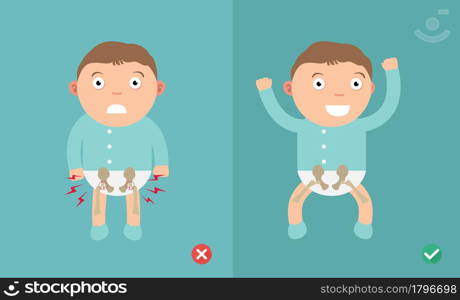 Best and worst positions child for prevention of hip dysplasia,illustration, vector