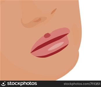 Blisters because of cold sores on lips vector illustration Virus infection skin care problem