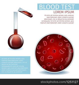 Blood Test. Hematology Medical Banner. Close Up View of Red Erythrocyte Cell and Blood Pouring from Test Tube to Beaker. Visual Material Aid for Clinic Use. Realistic Vector Illustration. Copy Space.. Blood Test. Visual Material Aid for Clinic Use.