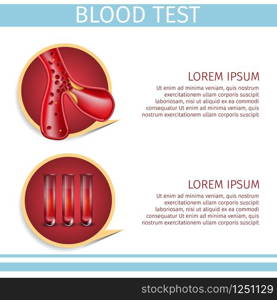 Blood Test Square Hematology Medical Banner Depicting Icons of Erythrocyte Cells Moving Inside of Vein or Artery and Red Sample Fluid in Test Tubes. Vector Realistic Illustration with Copy Space.. Blood Test Assay Square Hematology Medical Banner