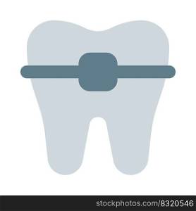 Braces for the teeth to overcome the misalignment of teeth growth