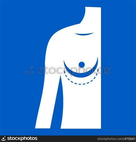 Breast implant surgery. icon white isolated on blue background vector illustration. Breast implant surgery. icon white