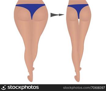 buttocks shape weight loss. Fat and slim thighs hips. before and after vector illustration