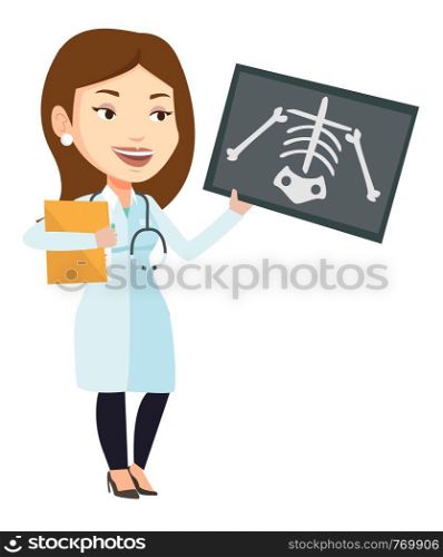 Caucasian female doctor examining a radiograph. Young doctor looking at a chest radiograph. Female doctor observing a skeleton radiograph. Vector flat design illustration isolated on white background.. Doctor examining radiograph vector illustration.