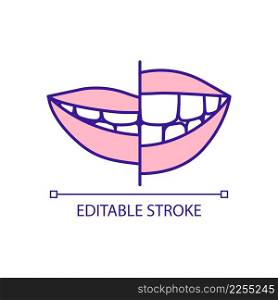 Changing teeth size RGB color icon. Improving smile and teeth appearance. Cosmetic dental treatment. Isolated vector illustration. Simple filled line drawing. Editable stroke. Arial font used. Changing teeth size RGB color icon