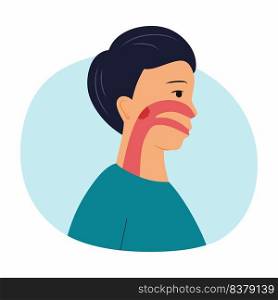 Child with adenoids. Polyps in  nose. Breathing problems in children. Vector character in  flat style. Illustration on  topic of medicine.