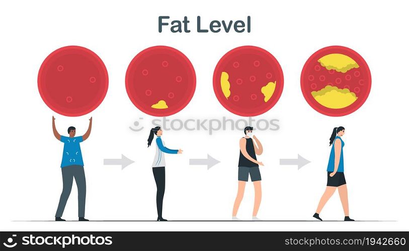 Cholesterol level. Layers of fat in blood vessel. Strong person becomes weak person. Cardiology vector illustration isolated on white background.