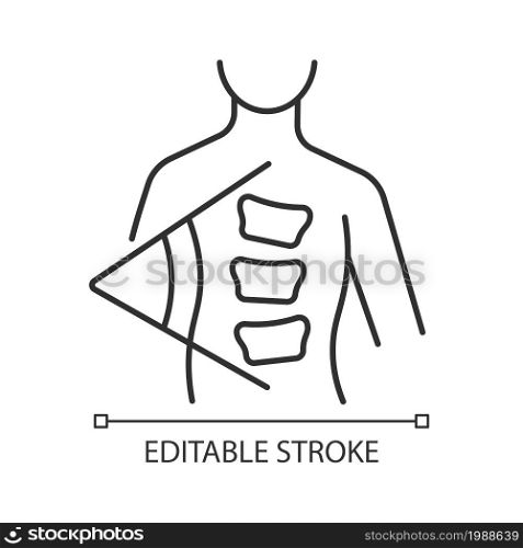 Cobb method linear icon. Cobb angle. Scoliosis degree measurement. Spine curve angle calculation. Thin line customizable illustration. Contour symbol. Vector isolated outline drawing. Editable stroke. Cobb method linear icon