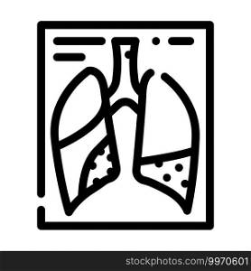 complications or pneumonia line icon vector. complications or pneumonia sign. isolated contour symbol black illustration. complications or pneumonia line icon vector illustration