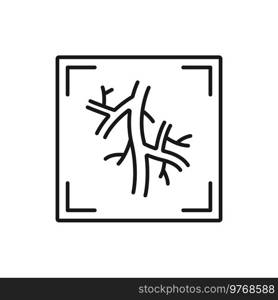 Computed tomography angiogram isolated CT test outline icon. Vector X-rays of blood vessels that go to heart, lung or brain, head or neck. CT scan of blood vessels isolated outline icon
