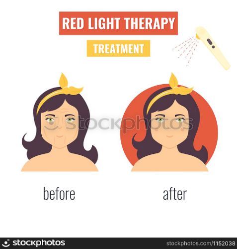 Concept of laser skin rejuvenation. Red light therapy.. Laser skin rejuvenation. Red light therapy