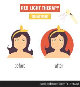 Concept of laser skin rejuvenation. Red light therapy.. Laser skin rejuvenation. Red light therapy