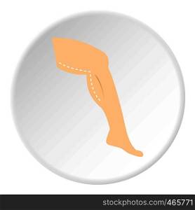 Cosmetic surgery, leg correction icon in flat circle isolated on white vector illustration for web. Cosmetic surgery, leg correction icon circle