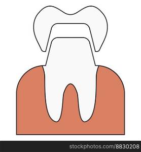 Crown dental tooth, white teeth, health medical dentist crown model