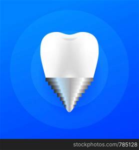 Crown Implant Tooth Icon. Human dental implant. Vector illustration.. Crown Implant Tooth Icon. Human dental implant. Vector stock illustration.