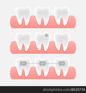 Dental care concept. Credit card icon. Vector design. Medical insurance card icon.. Dental care concept. Credit card icon. Vector design. Medical insurance card icon