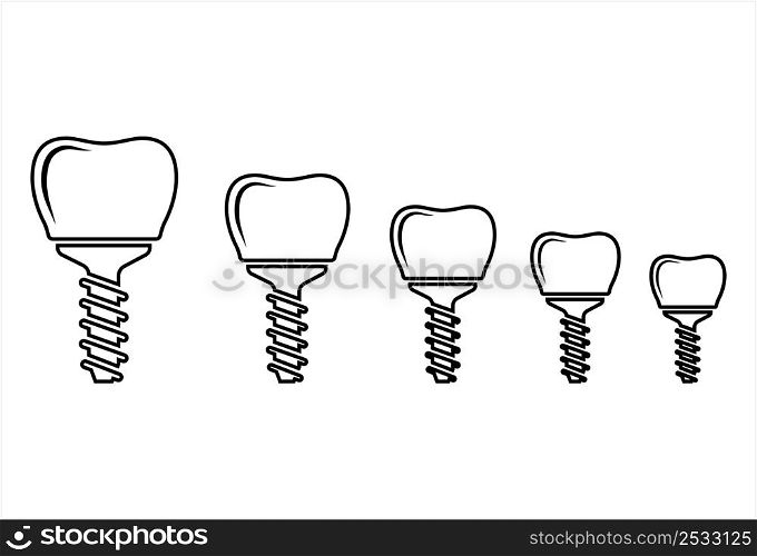 Dental Implant Icon, Tooth Endosseous Implant, Fixture Vector Art Illustration