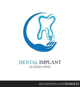 Dental implant logo design concept vector, Dental Care logo template