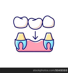 Dental prosthetics RGB color icon. Tooth recovery stomatology technics. Implant design. Instruments for dental treatment. Contemporary dental treatment. Isolated vector illustration. Dental prosthetics RGB color icon