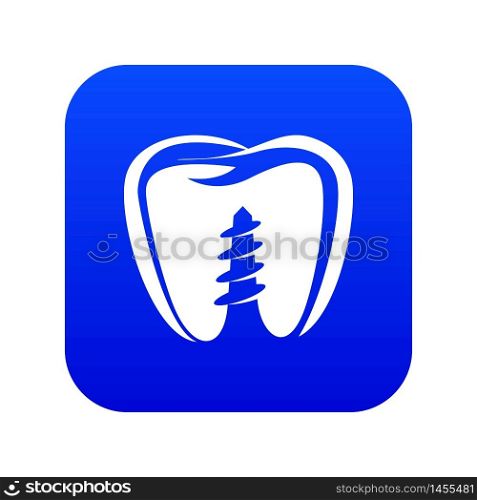 Denture implant icon. Simple illustration of denture implant vector icon for web. Denture implant icon, simple black style