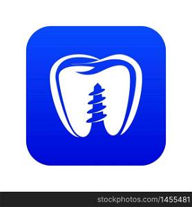 Denture implant icon. Simple illustration of denture implant vector icon for web. Denture implant icon, simple black style