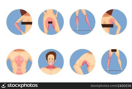 Depilation hair removal zones for men and women cartoon style blue background round icons set isolated vector illustration . Depilation Zones Man Woman Icons Set 