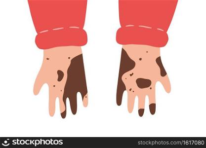 Dirty unwashed hands. Isolated vector illustration in flat style on white background. Dirty unwashed hands. Isolated vector illustration in flat style