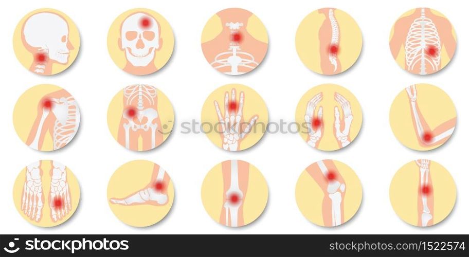 Disease of the joints and bones icon set on white background, bone x-ray image of human joints, anatomy skeleton flat design vector illustration.