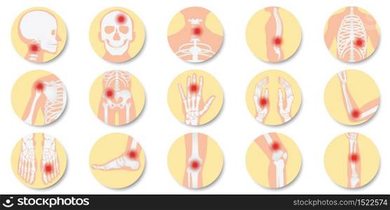 Disease of the joints and bones icon set on white background, bone x-ray image of human joints, anatomy skeleton flat design vector illustration.
