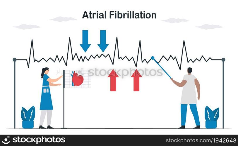 ECG signal of atrial fibrillation. Doctors check and analyze a heart disease. Cardiology vector illustration.