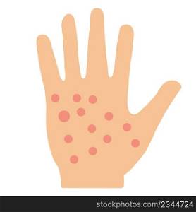 eczema hand skin icon on white background. allergic reaction symbol. irritation on hand sign. flat style.