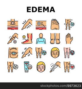 Edema Disease Symptom Collection Icons Set Vector. Venous And Fatty, Lymphatic And Hypoproteinemic, Allergic And Heart Edema Health Problem Concept Linear Pictograms. Contour Color Illustrations. Edema Disease Symptom Collection Icons Set Vector