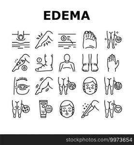 Edema Disease Symptom Collection Icons Set Vector. Venous And Fatty, Lymphatic And Hypoproteinemic, Allergic And Heart Edema Health Problem Black Contour Illustrations. Edema Disease Symptom Collection Icons Set Vector
